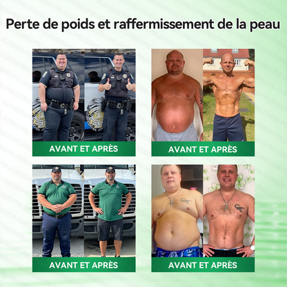 𝑩𝒐𝒖𝒕𝒊𝒒𝒖𝒆 𝒐𝒇𝒇𝒊𝒄𝒊𝒆𝒍𝒍𝒆 | 👍👍𝐆𝐋𝗢𝗥𝗘𝗡𝗗𝑨®𝑴𝒐𝒓𝒊𝐧𝐠𝙖 · 𝘽𝙚𝙧𝙗é𝙧𝒊𝒏𝒆 ×𝐍𝘼𝗗+ 𝟭0-𝒆𝒏-𝟏 𝐏𝐚𝙩𝙘𝙝 𝙈𝙞𝙘𝙧𝙤𝙣é𝙚𝒅𝒍𝒆 𝑨𝒗𝒂𝐧𝐜é 𝙉𝙖𝒏𝒐🇫🇷(𝐔𝐧𝐞 𝐬𝐞𝐮𝐥𝐞 𝐟𝐨𝐢𝐬 𝐩𝐚𝐫 𝐣𝐨𝐮𝐫, 𝐜𝐡𝐚𝐧𝐠𝐞𝐦𝐞𝐧𝐭𝐬 𝐯𝐢𝐬𝐢𝐛𝐥𝐞𝐬 𝐞𝐧 𝟕 𝐣𝐨𝐮𝐫𝐬） ✅ 𝐏𝐨𝐮𝐫 𝐥’𝐨𝐛é𝐬𝐢𝐭é, 🅟🅔🅐🅤 🅡🅔🅛â🅒🅗é🅔,𝐝𝐢𝐚𝐛è𝐭𝐞, 𝐚𝐩𝐧é𝐞 𝐝𝐮 𝐬𝐨𝐦𝐦𝐞𝐢𝐥, 𝐩𝐫𝐨𝐛𝐥è𝐦𝐞𝐬 𝐚𝐫𝐭𝐢𝐜𝐮𝐥𝐚𝐢𝐫𝐞𝐬, 𝐞𝐭 𝐛𝐢𝐞𝐧 𝐩𝐥𝐮𝐬