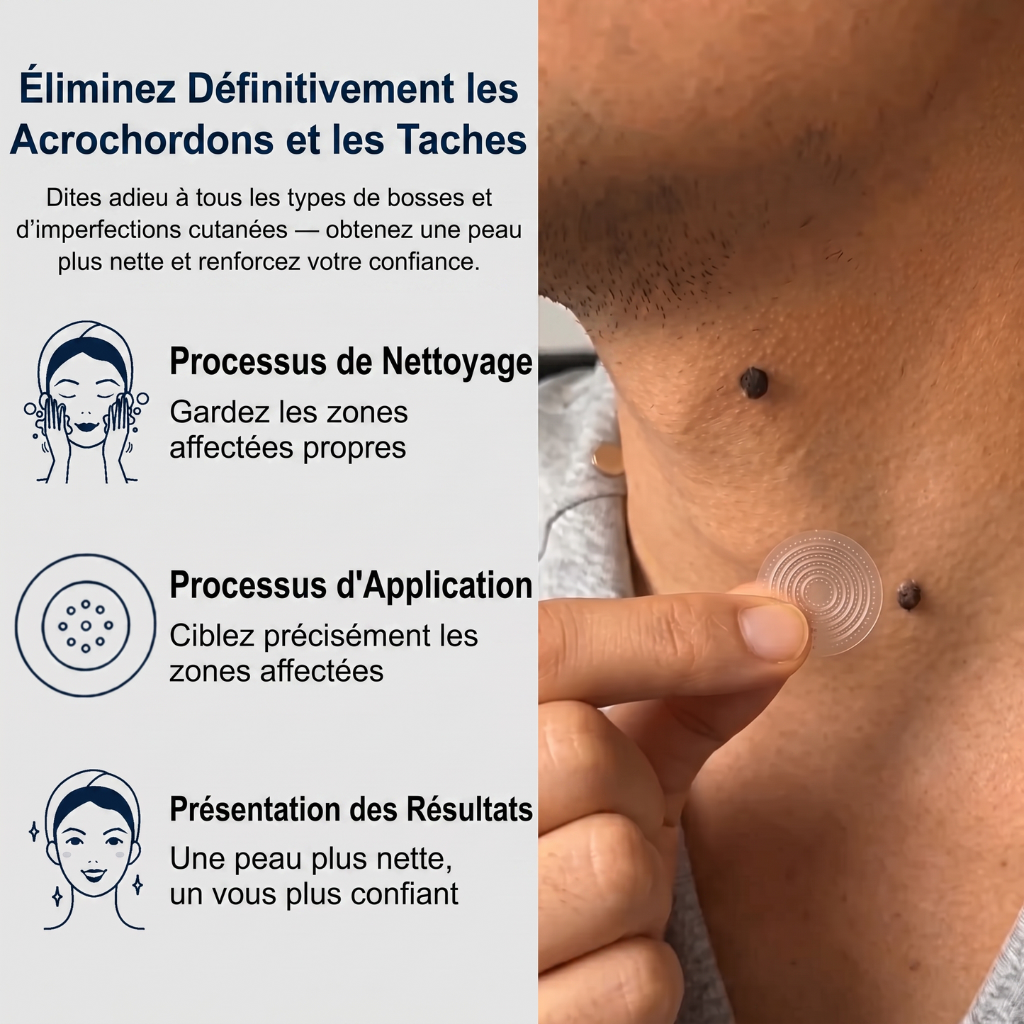 【🫧 Dernier jour : -70 % 🫧】🇫🇷 𝐇𝐞𝒂𝒍𝗿𝗶𝙯𝙚® Patch 2-en-1 à micro-aiguilles & hydrocolloïde | Aide à réduire l’apparence des grains de beauté, verrues, acné et étiquettes cutanées | Patchs invisibles visage & corps.