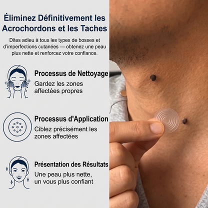 【🫧 Dernier jour : -70 % 🫧】🇫🇷 𝐇𝐞𝒂𝒍𝗿𝗶𝙯𝙚® Patch 2-en-1 à micro-aiguilles & hydrocolloïde | Aide à réduire l’apparence des grains de beauté, verrues, acné et étiquettes cutanées | Patchs invisibles visage & corps.